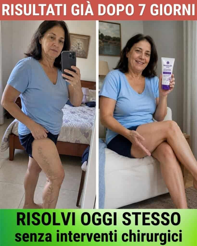Donna mostra miglioramenti alle gambe dopo 7 giorni di trattamento naturale.