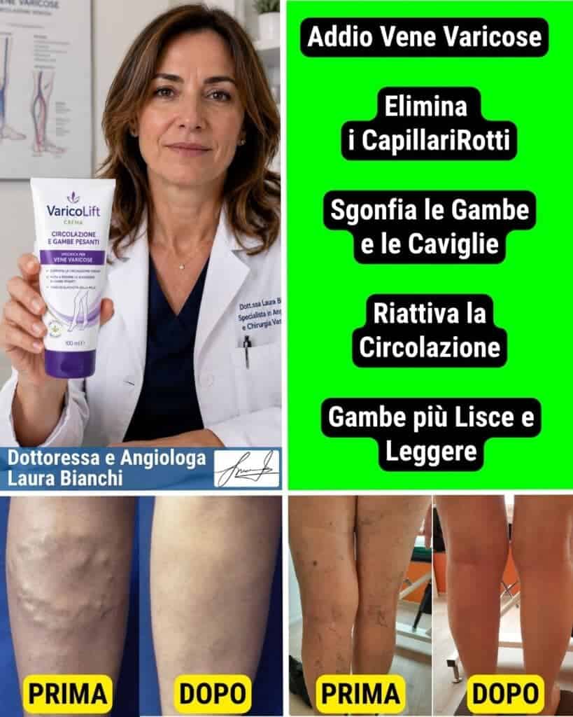 Prodotto Varico Lift 2x1 per migliorare la circolazione e le gambe.