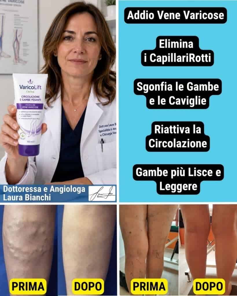 Prodotto Varico Lift 1x per vene varicose e circolazione migliorata.