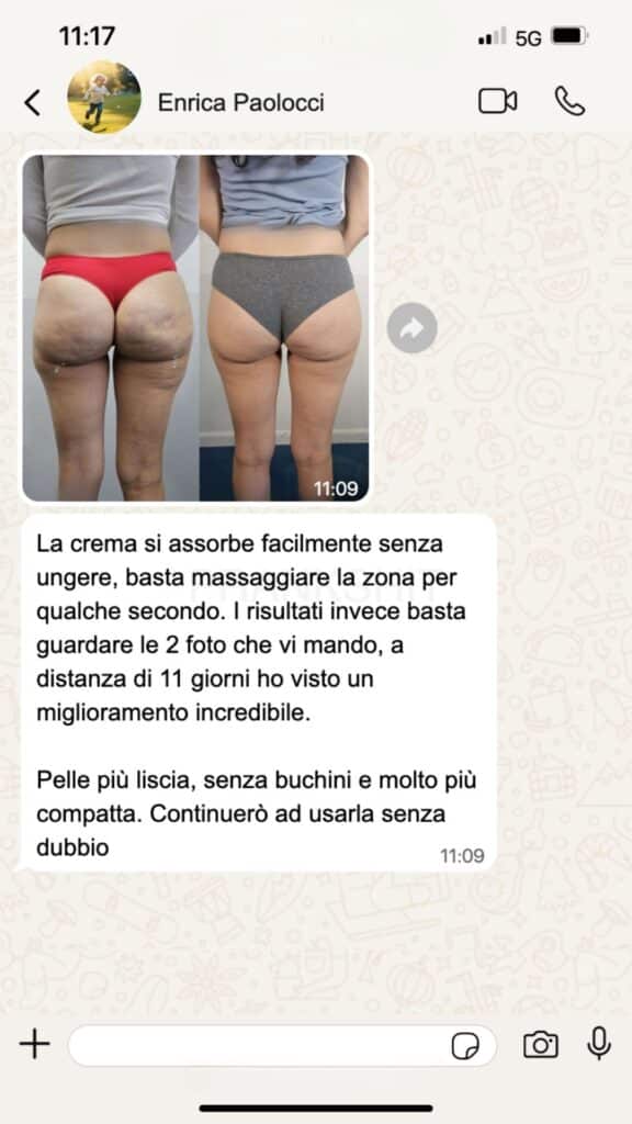 Prima e dopo trattamento corpo, miglioramento visibile.