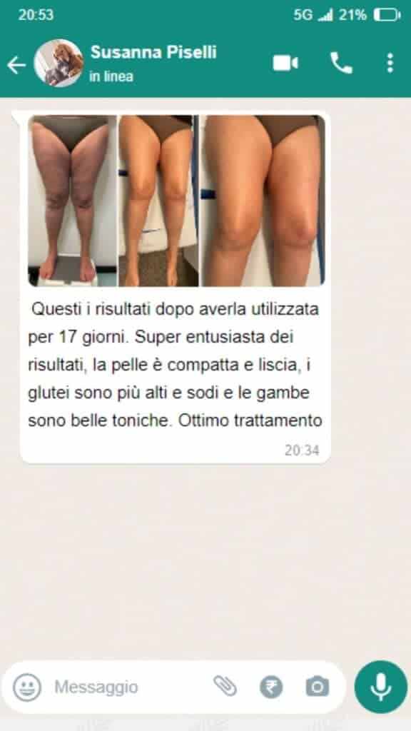 Prima e dopo trattamento con Spiru Lipo, pelle compatta e gambe toniche.