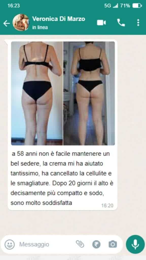 Prima e dopo l'uso della crema anticellulite su gambe e glutei.